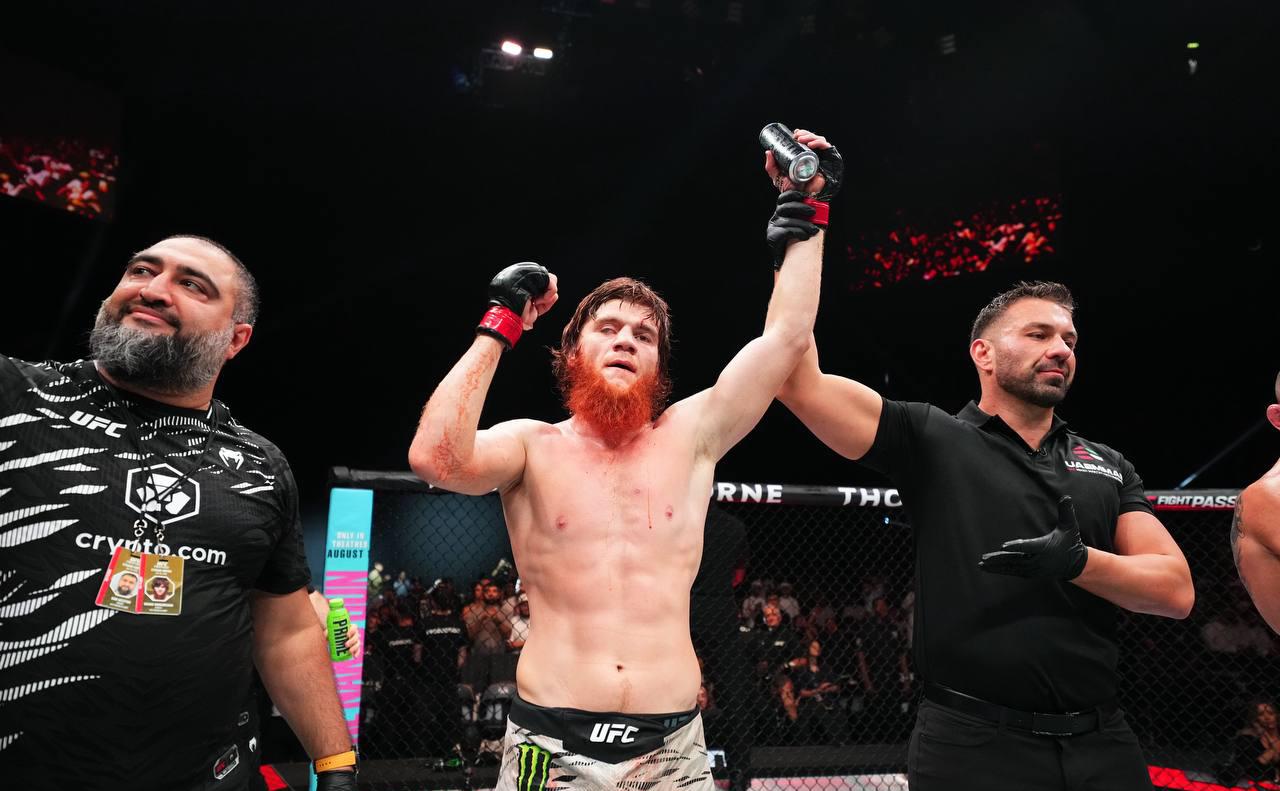 Шара-Буллет-был-госпитализирован-после-победы-на-ufc-из-за-перелома-носа